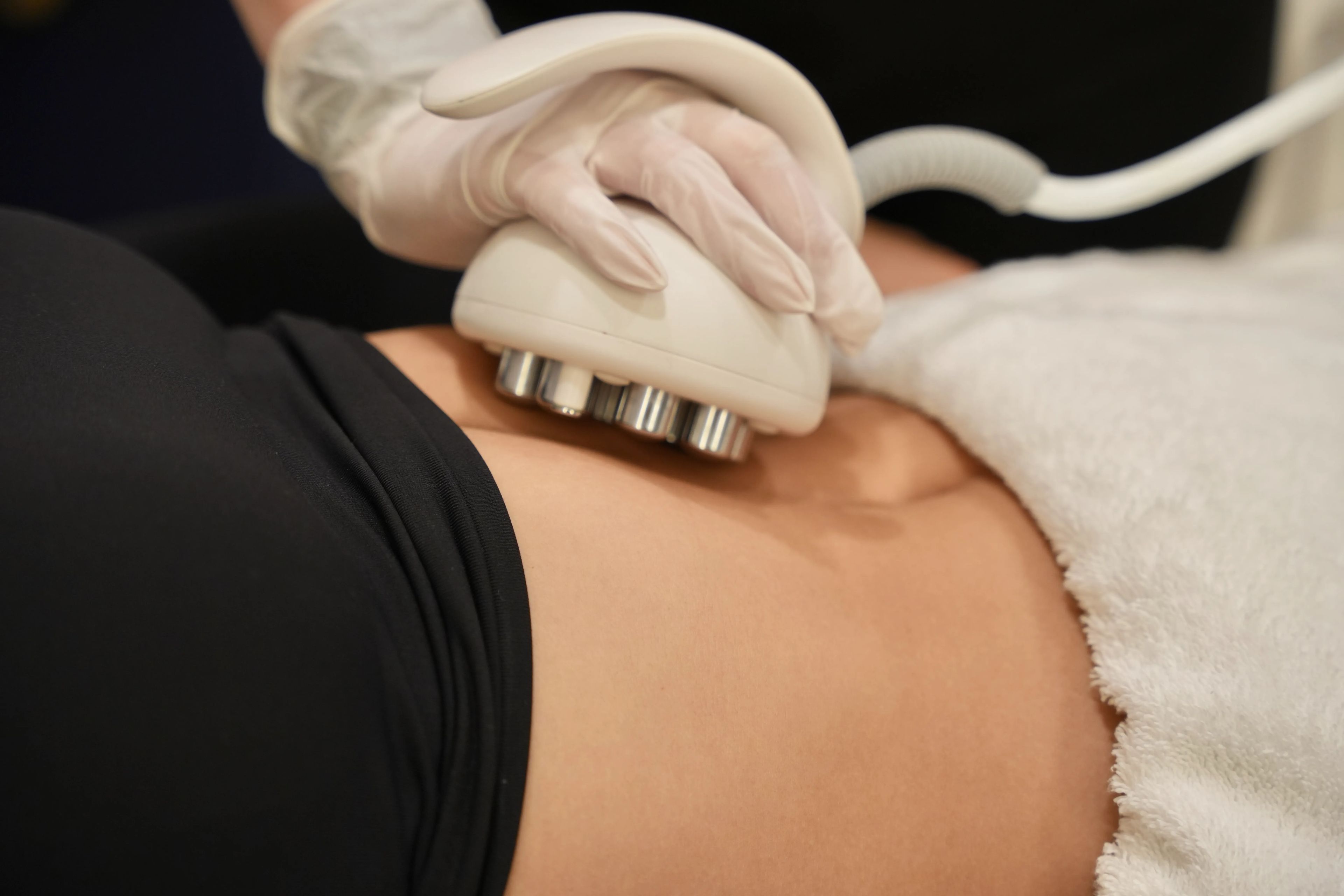 What to expect from Venus OctiPolar™ Fat Reduction & Body Contouring treatment at Toronto medical spa - treatment journey